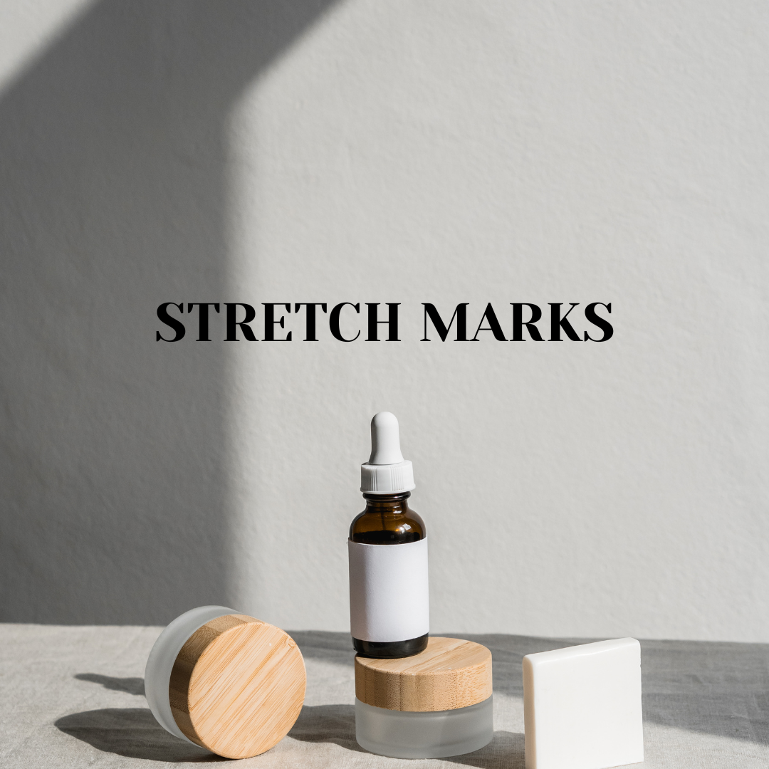 Stretch Marks